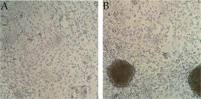 The Culture Dish Surface Influences the Phenotype and Cytokine Production of <mark class="highlighted">Human Monocyte-Derived Dendritic Cells</mark>